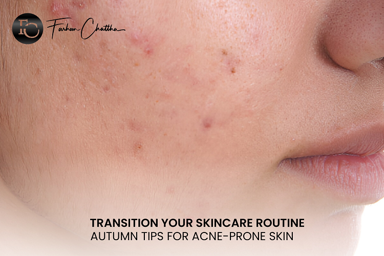 Transition your Skincare Routine Autumn Tips for Acne-Prone Skin